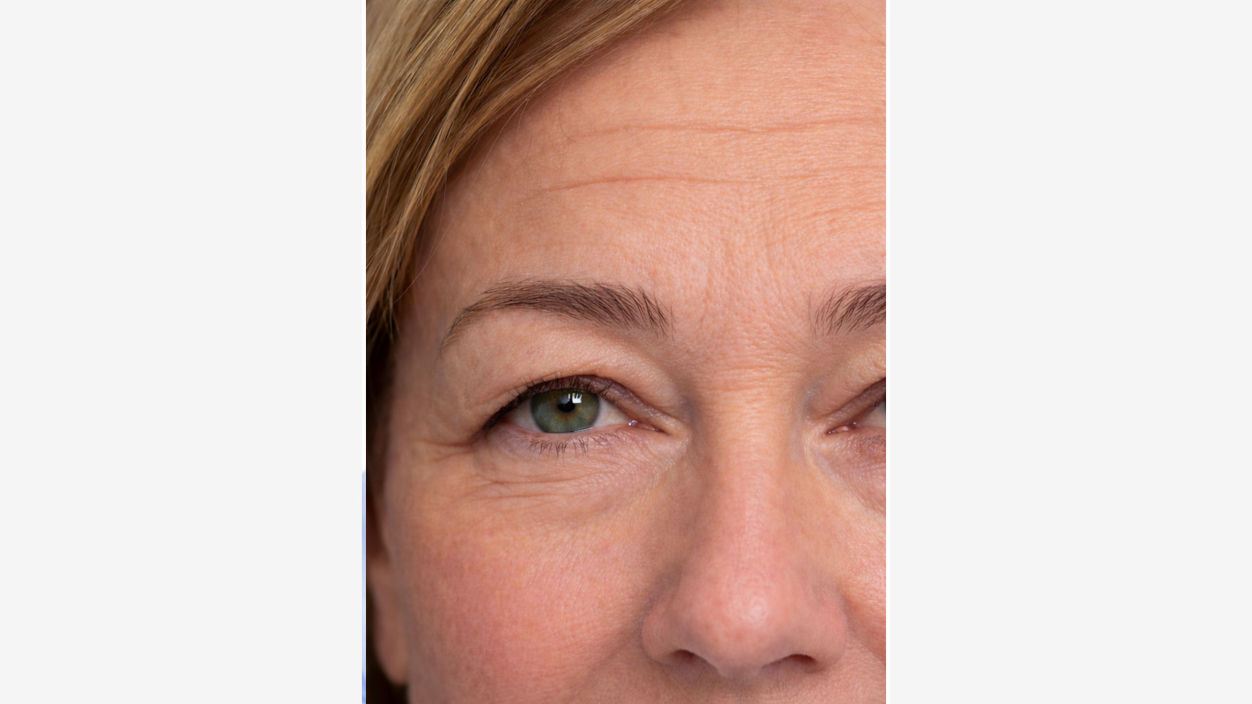 antes_horizontal_completo2